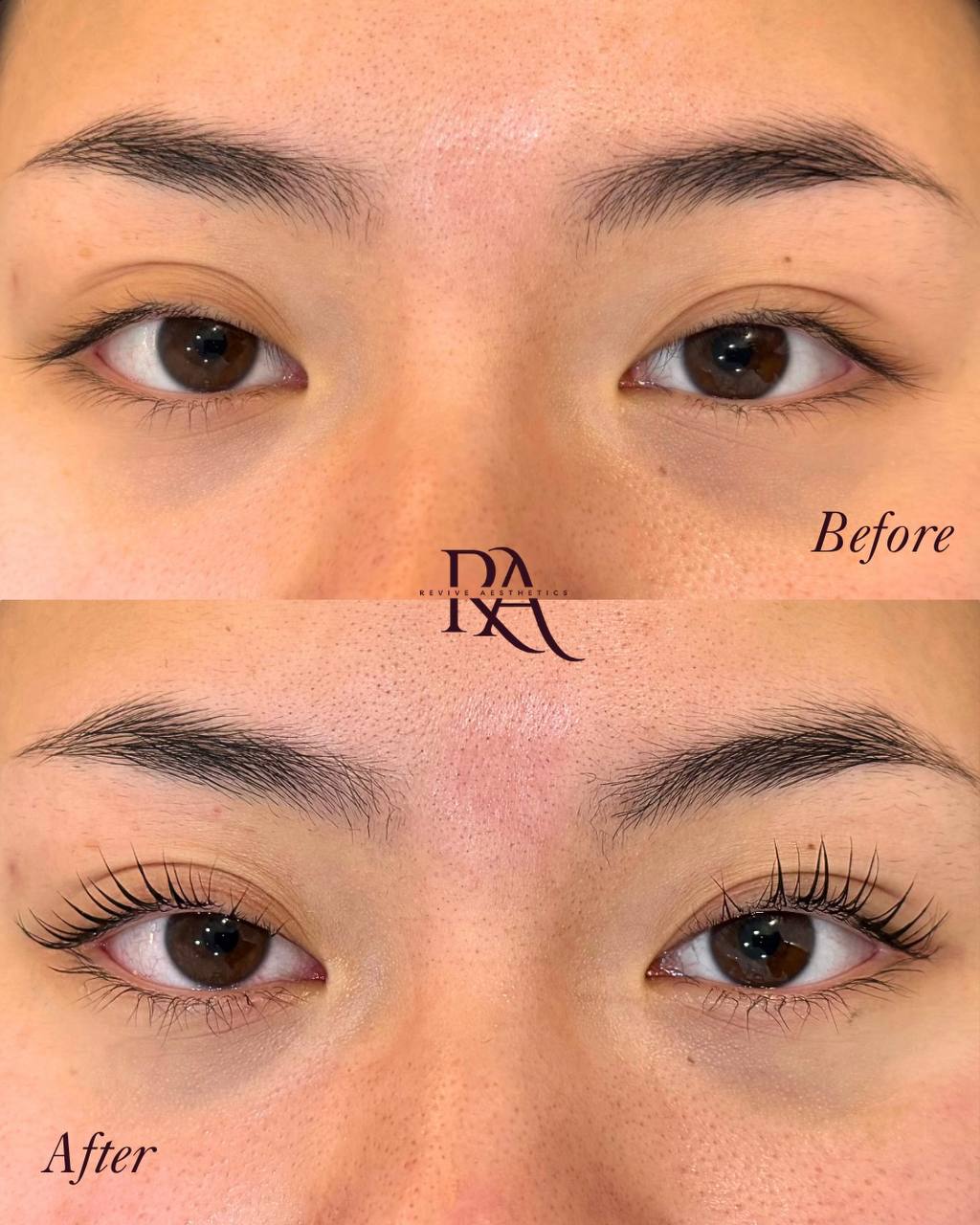 Korean lash lift before and after — Revive Aesthetics Adelaide