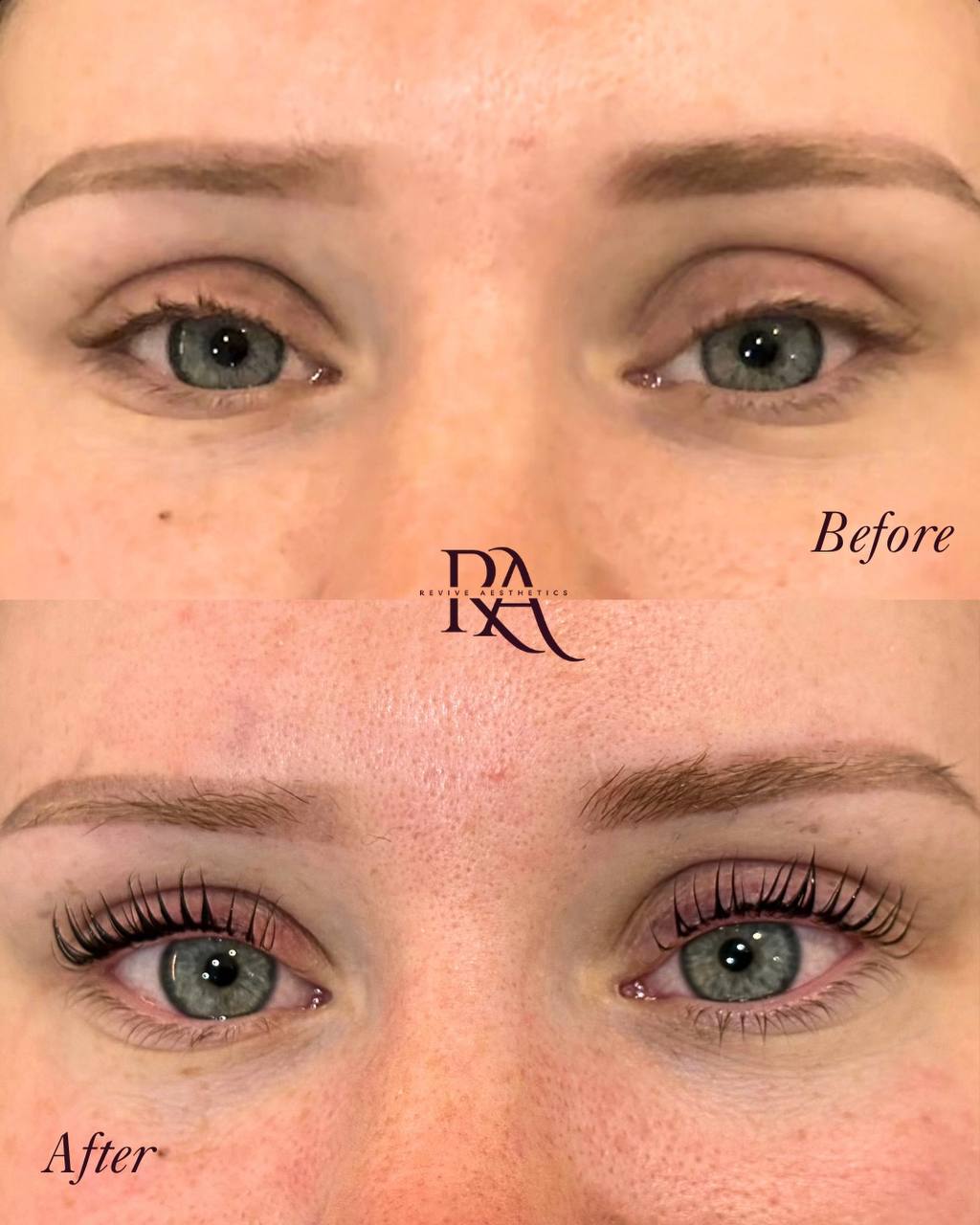 Korean lash lift before and after — Revive Aesthetics Adelaide