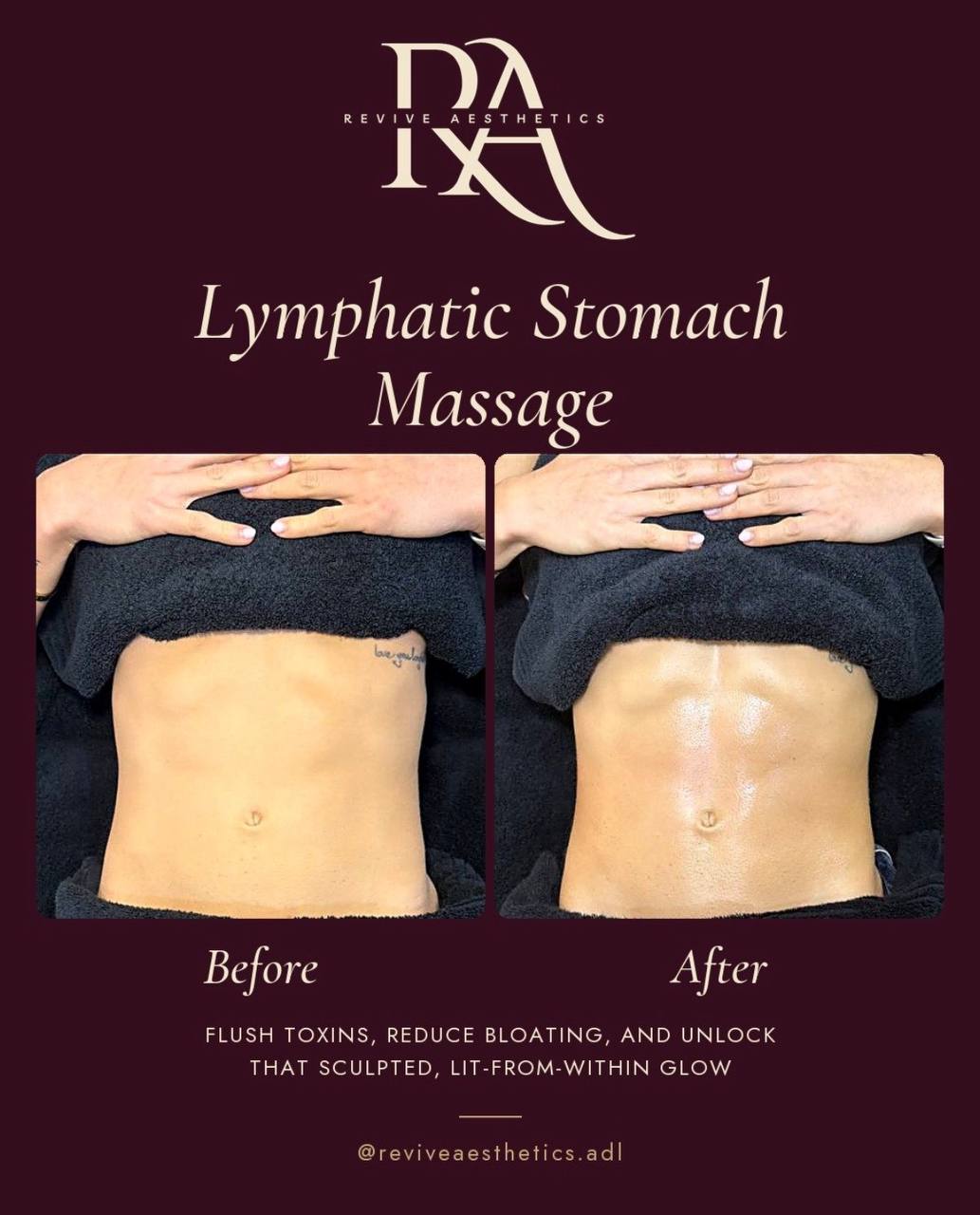 Lymphatic stomach drainage massage before and after — Revive Aesthetics Adelaide